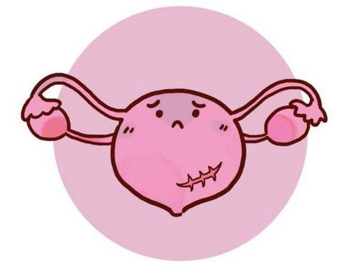 福州中医治卵巢癌骨转移
