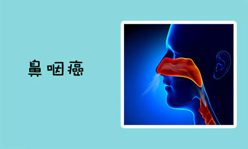 福州中医怎么安排鼻咽癌饮食好