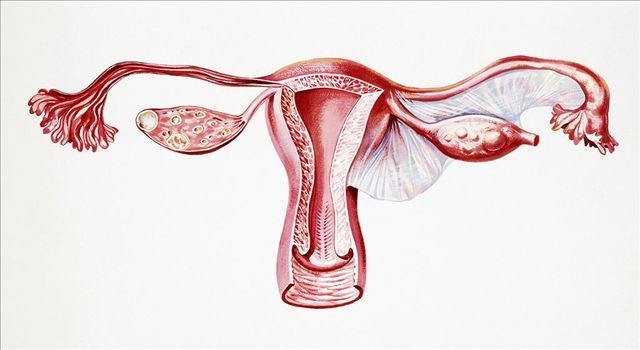 那种女性易得子宫内膜癌?福州御和堂老中医解析